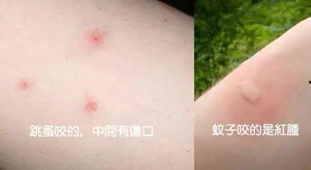 跳蚤咬图片,揭秘常见家居害虫的侵扰